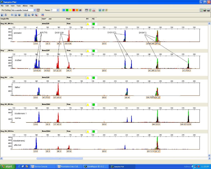 Генетическая диагностика у эмбрионов методом КФ-ПЦР Генетическая диагностика у эмбрионов методом КФ-ПЦР