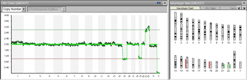 XX-15 -19 +21+22.jpg XX-15 -19 +21+22.jpg