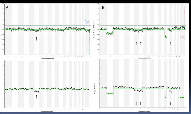 Результаты анализа, полученные с помощью метода CGH и NGS Результаты анализа, полученные с помощью метода CGH и NGS